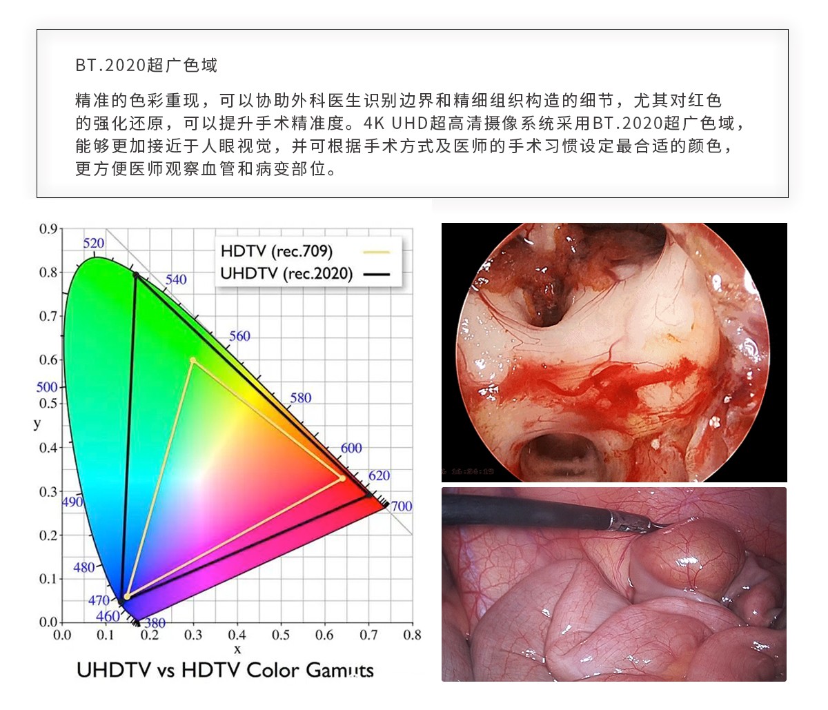 【4K醫(yī)用內(nèi)窺鏡攝像系統(tǒng)】您的第一臺“4K”找到了嗎？