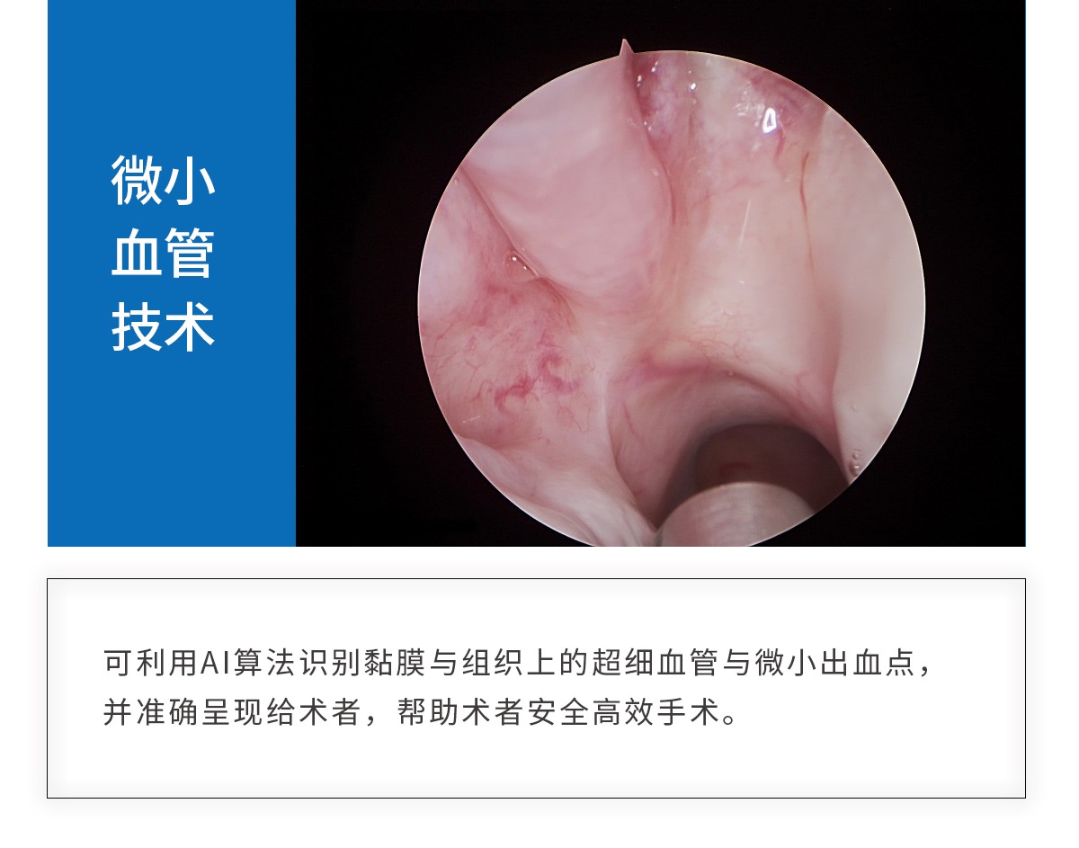 【4K醫(yī)用內(nèi)窺鏡攝像系統(tǒng)】您的第一臺“4K”找到了嗎？