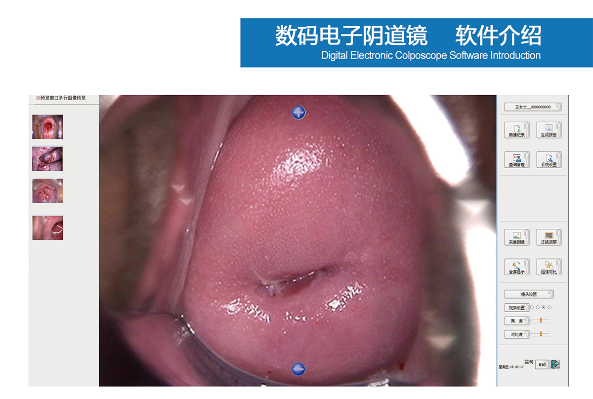 益柯達(dá)數(shù)碼電子陰道鏡打包發(fā)貨