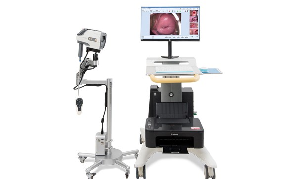 數(shù)碼電子陰道鏡與TCT技術(shù)診斷早期宮頸癌